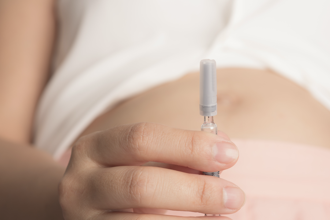 Stimolazione ormonale prima del trattamento FIVET
